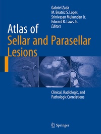 Abbildung von: Atlas of Sellar and Parasellar Lesions - Springer