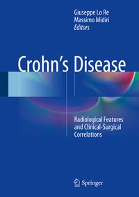 Abbildung von: Crohn's Disease - Springer