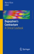 Cover: Dupuytren's Contracture - Springer