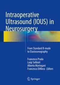 Abbildung von: Intraoperative Ultrasound (IOUS) in Neurosurgery - Springer