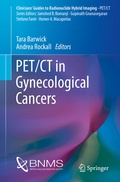 Cover: PET/CT in Gynecological Cancers - Springer
