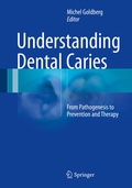 Cover: Understanding Dental Caries - Springer