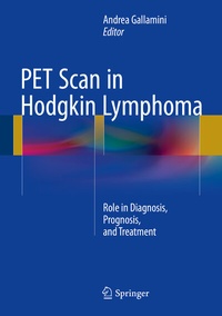 Abbildung von: PET Scan in Hodgkin Lymphoma - Springer