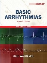 Abbildung von: Basic Arrhythmias - Pearson