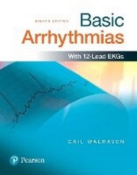 Abbildung von: Basic Arrhythmias - Pearson