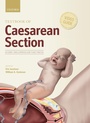 Cover: Textbook of Caesarean Section - Oxford University Press