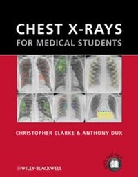 Enlarge image Cover: Chest X-rays for Medical Students - Wiley