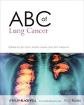 Cover: ABC of Lung Cancer - BMJ BOOKS