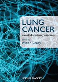 Abbildung von: Lung Cancer - Wiley