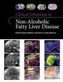 Bild: Clinical Dilemmas in Non-Alcoholic Fatty Liver Disease - Wiley