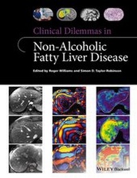 Bild vergrößern Bild: Clinical Dilemmas in Non-Alcoholic Fatty Liver Disease - Wiley