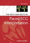 Cover: The Nuts and bolts of Paced ECG Interpretation - Wiley