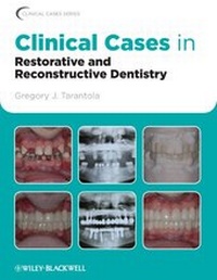 Abbildung von: Clinical Cases in Restorative and Reconstructive Dentistry - Wiley