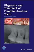 Cover: Diagnosis and Treatment of Furcation-Involved Teeth - Wiley