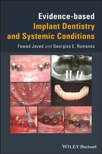Abbildung von: Evidence-based Implant Dentistry and Systemic Conditions - Wiley