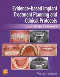 Cover: Evidence-based Implant Treatment Planning and Clinical Protocols - Wiley