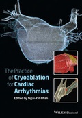 Bild: The Practice of Catheter Cryoablation for Cardiac Arrhythmias - Wiley