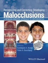 Enlarge image Cover: Recognizing and Correcting Developing Malocclusions - Wiley