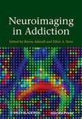Bild: Neuroimaging in Addiction - Wiley