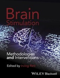 Abbildung von: Brain Stimulation - Wiley