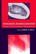 Bild: Myocardial Revascularization - Wiley