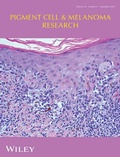 Abbildung von: Pigment Cell & Melanoma Research - Wiley