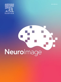 Bild vergrößern Bild: NeuroImage - Academic Press