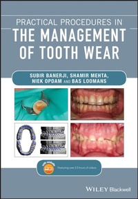 Enlarge image Cover: Practical Procedures in the Management of Tooth Wear - Wiley-Blackwell