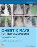 Cover: Chest X-Rays for Medical Students - Wiley-Blackwell