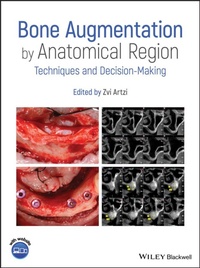 Abbildung von: Bone Augmentation by Anatomical Region: Techniques and Decision-Making - Wiley-Blackwell
