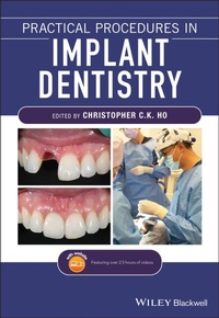 Enlarge image Cover: Practical Procedures in Implant Dentistry - Wiley-Blackwell