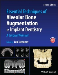 Abbildung von: Essential Techniques of Alveolar Bone Augmentation in Implant Dentistry - Wiley-Blackwell