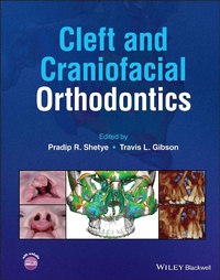 Abbildung von: Cleft and Craniofacial Orthodontics - Wiley-Blackwell