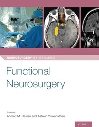 Enlarge image Cover: Functional Neurosurgery - Oxford University Press Inc