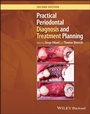 Cover: Practical Periodontal Diagnosis and Treatment Planning - Wiley-Blackwell